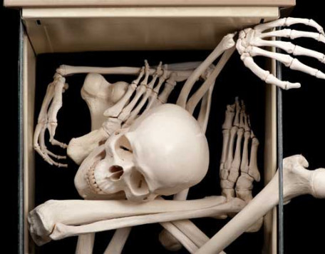 Body 11 Bones